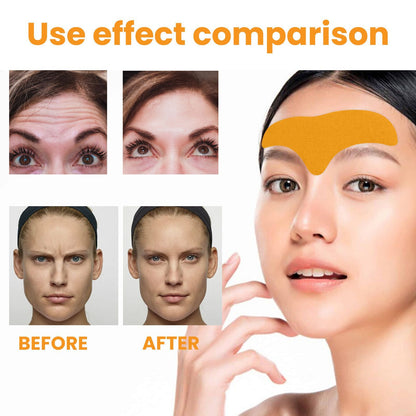 Forehead Wrinkle Patch - Lift & Smooth Facial Skin